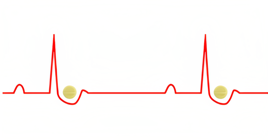 Digoxin Toxicity EKG Findings