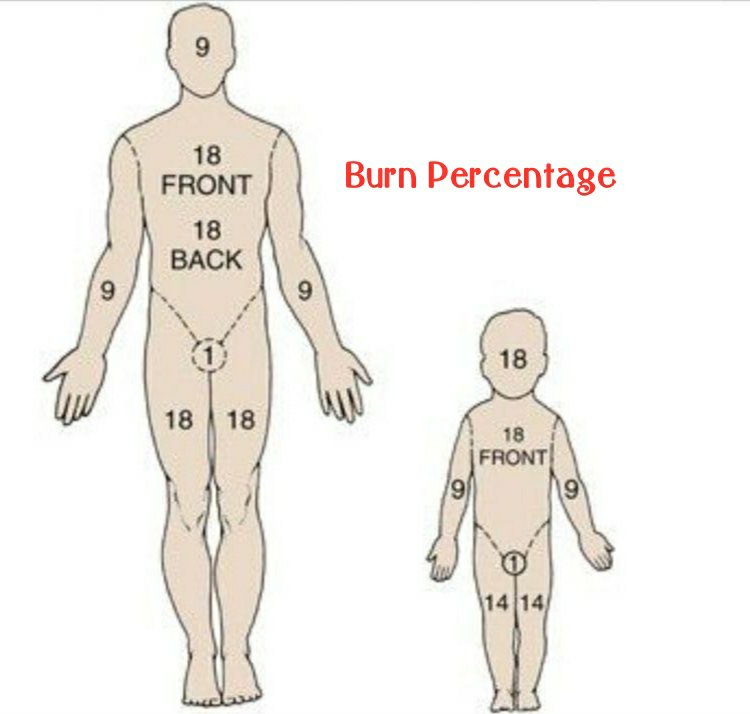 Burn Percentage