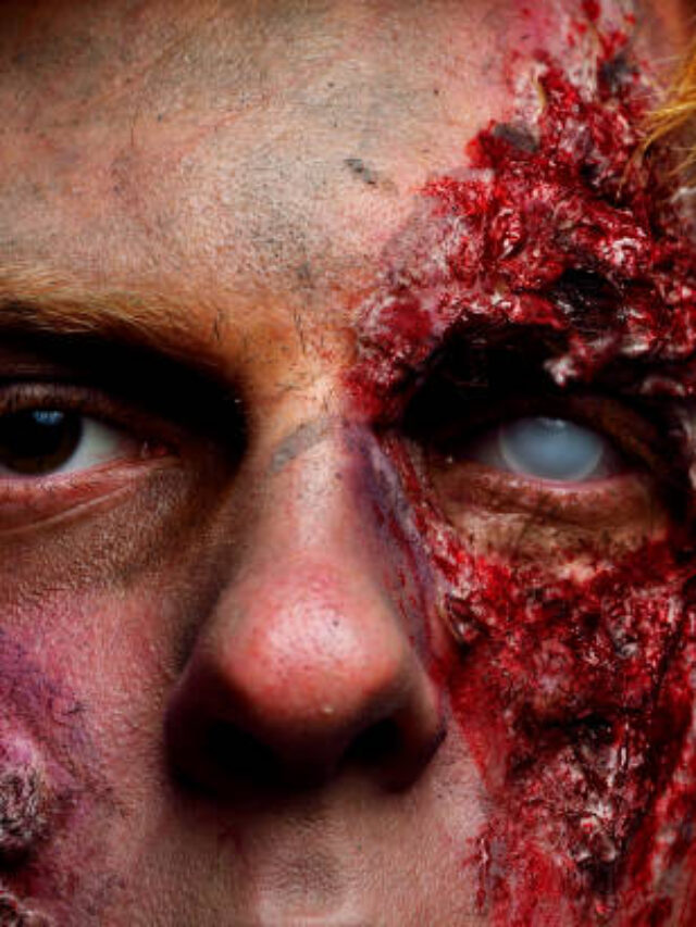 The Shocking Reality of a Degloved Face: Understanding and Coping with This Traumatic Injury