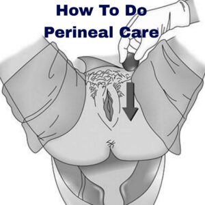 How to do perineal care