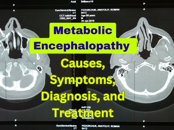 Metabolic Encephalopathy: Causes, Symptoms, Diagnosis, and Treatment